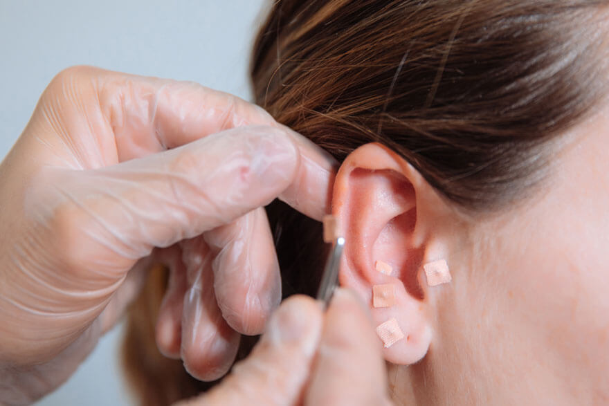 ear_accupuncture_img